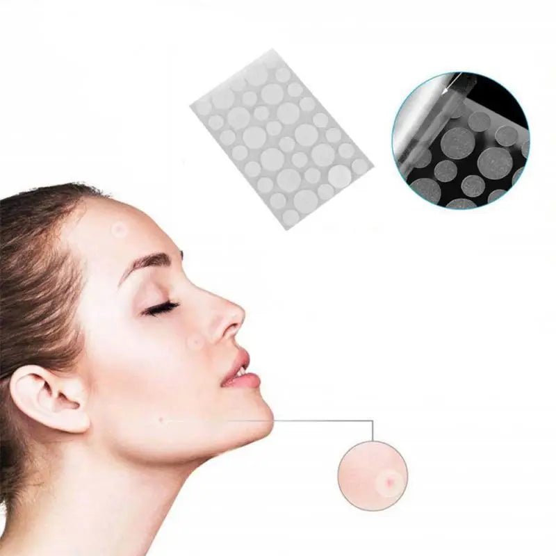 36pcs (per set) Pimple Remover -  Master Patch Acne Treatment - INVISIBLE ACNE PATCH- Face Skin Care Tools